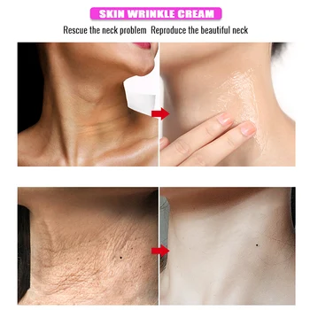 Deschiderea culorii pielii Fine Linii de Gât Crema Anti-Rid de Albire Fermitate Masca Gât de Îngrijire a Pielii Pentru Femei BUTT666